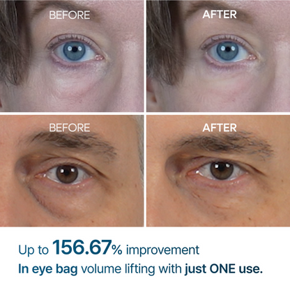 Eyephalt Eye Cream | Puffiness, Dark Circles, Wrinkles, EGF Anti-Aging, Niacinamide & Ceramide, 0.33 fl.oz