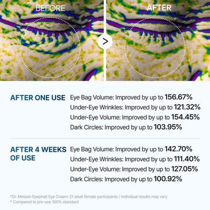 Eyephalt Eye Cream | Puffiness, Dark Circles, Wrinkles, EGF Anti-Aging, Niacinamide & Ceramide, 0.33 fl.oz